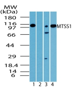 MTSS1 / MIM Antibody - Western blot of MTSS1 in human testis lysate in the 1) absence and 2) presence of immunizing peptide, 3) mouse and 4) rat  testis lysate using antibody at 2 ug/ml, 4 ug/ml and 2 ug/ml, respectively.