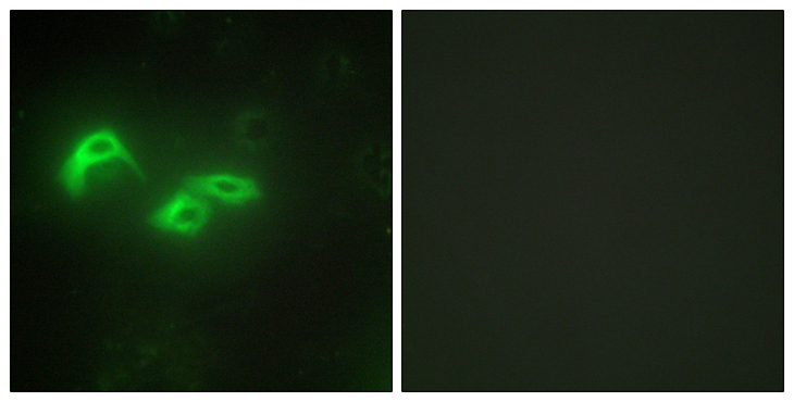 MtTFA / TFAM Antibody - Immunofluorescence analysis of HepG2 cells, using TFAM Antibody. The picture on the right is blocked with the synthesized peptide.