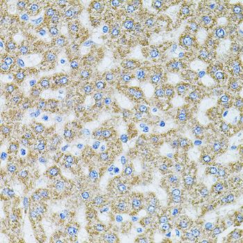 MTTP / MTP Antibody - Immunohistochemistry of paraffin-embedded rat liver tissue.