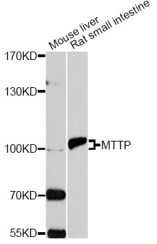 MTTP / MTP Antibody - Western blot analysis of extracts of various cell lines, using MTTP antibody at 1:1000 dilution. The secondary antibody used was an HRP Goat Anti-Rabbit IgG (H+L) at 1:10000 dilution. Lysates were loaded 25ug per lane and 3% nonfat dry milk in TBST was used for blocking. An ECL Kit was used for detection and the exposure time was 90s.
