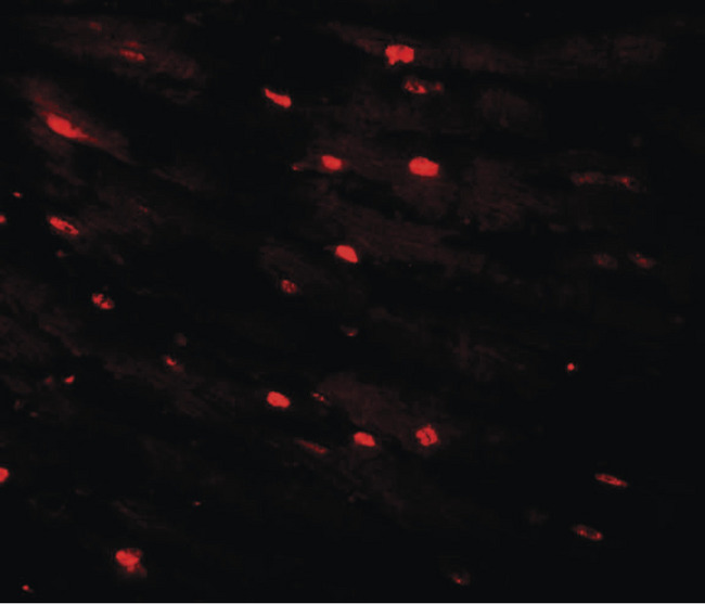 MTUS2 Antibody - Immunofluorescence of CAZIP in mouse heart tissue with CAZIP antibody at 20 ug/ml.