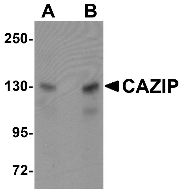 MTUS2 Antibody - Western blot analysis of CAZIP in A20 cell lysate with CAZIP antibody at (A) 0.5 and (B) 1 ug/ml.