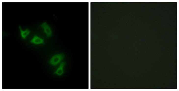 MUC13 Antibody - Immunofluorescence analysis of HepG2 cells, using MUC13 Antibody. The picture on the right is blocked with the synthesized peptide.