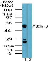 MUC13 Antibody - Western blot of Mucin 13 in human kidney lysate in the 1) absence and2) presence of immunizing peptide using Peptide-affinity Purified Polyclonal Antibody to Mucin 13 at 0.25 ug/ml.