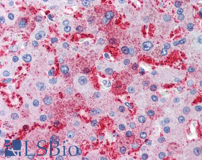 MUC13 Antibody - Anti-MUC13 antibody IHC of human liver. Immunohistochemistry of formalin-fixed, paraffin-embedded tissue after heat-induced antigen retrieval.