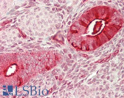 MUC16 / CA125 Antibody - Human Uterus: Formalin-Fixed, Paraffin-Embedded (FFPE)