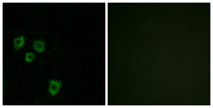 MUC16 / CA125 Antibody - Immunofluorescence analysis of HepG2 cells, using MUC16 Antibody. The picture on the right is blocked with the synthesized peptide.