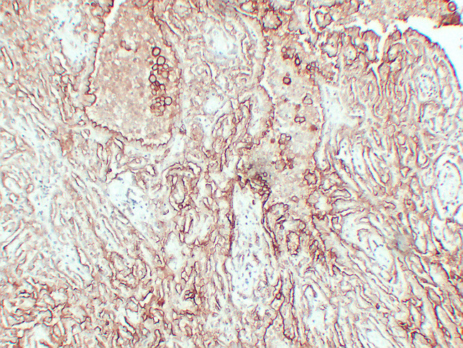 MUC16 / CA125 Antibody - Mesothelioma 1