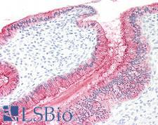 MUC16 / CA125 Antibody - Human Cervix: Formalin-Fixed, Paraffin-Embedded (FFPE)