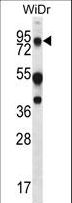 MUC20 Antibody - MUC20 Antibody western blot of WiDr cell line lysates (35 ug/lane). The MUC20 antibody detected the MUC20 protein (arrow).