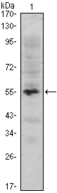 MUM1 Antibody - Western blot using MUM1 monoclonal antibody against human MUM1 (AA: 590-711) recombinant protein. (Expected MW is 39.8 kDa)