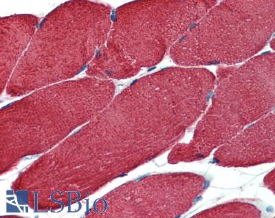 Muscle Actin Antibody - Human Skeletal Muscle: Formalin-Fixed, Paraffin-Embedded (FFPE)