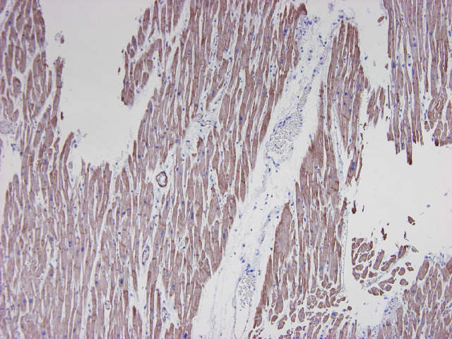 Muscle Actin Antibody - Paraffin section of human cardiac muscle immunostained with HHF35 (1:250)