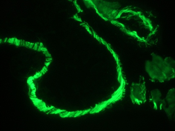 Muscle Actin Antibody - Immunofluorescence staining of intestinal muscle tissue in 1 month old zebrafish embryo