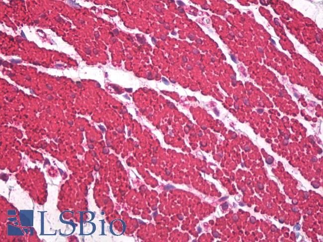 Muscle Actin Antibody - Anti-Muscle Actin antibody IHC staining of human colon, smooth muscle. Immunohistochemistry of formalin-fixed, paraffin-embedded tissue after heat-induced antigen retrieval.
