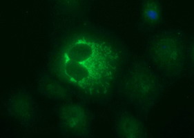 MUT / MCM Antibody - Immunofluorescent staining of COS7 cells transiently transfected by pCMV6-ENTRY MUT using Anti-MUT Antibody at 1:100 dilution.