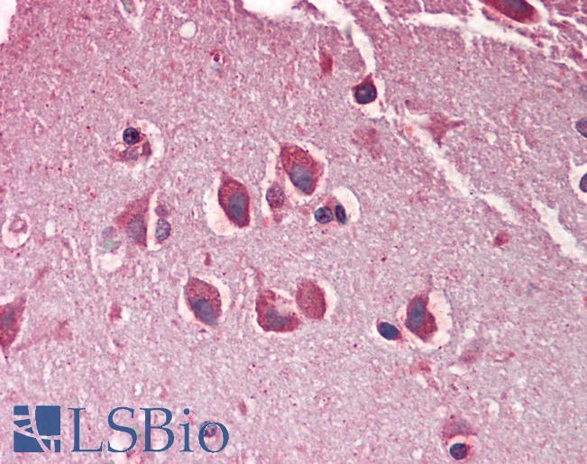 MXRA5 Antibody - Anti-MXRA5 antibody IHC staining of human brain, cortex. Immunohistochemistry of formalin-fixed, paraffin-embedded tissue after heat-induced antigen retrieval. Antibody concentration 5 ug/ml.
