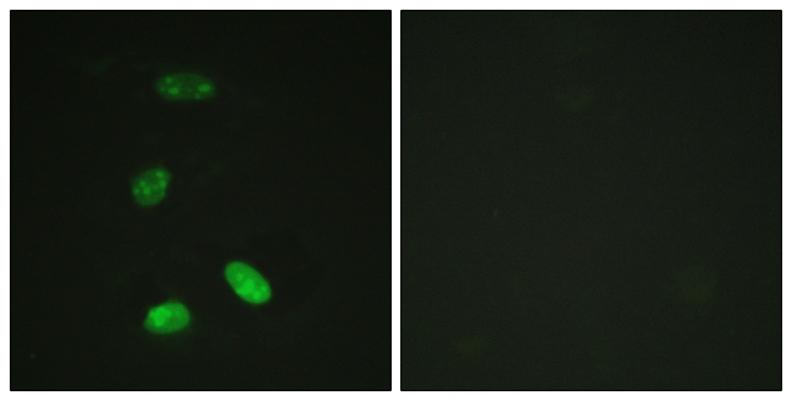 MYB / c-Myb Antibody - Immunofluorescence analysis of HeLa cells, using MYB Antibody. The picture on the right is blocked with the synthesized peptide.