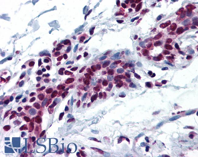 MYB / c-Myb Antibody - Anti-c-Myb antibody IHC of human breast. Immunohistochemistry of formalin-fixed, paraffin-embedded tissue after heat-induced antigen retrieval. Antibody dilution 1:200.
