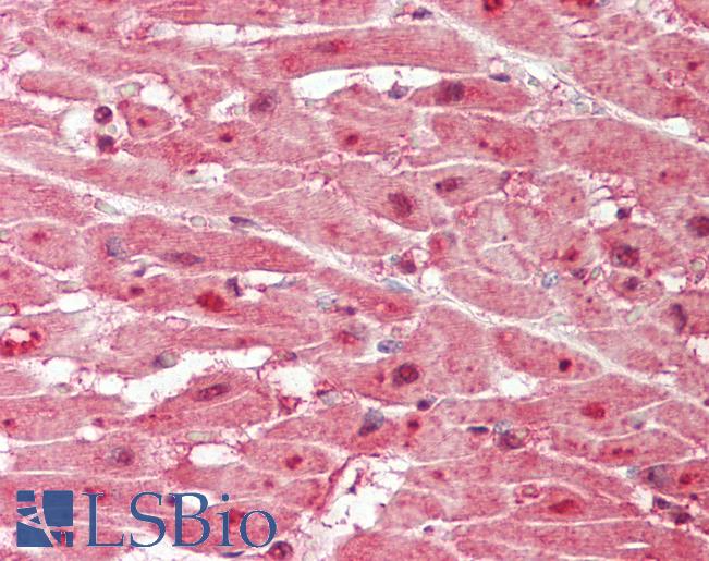 MYB / c-Myb Antibody - Human Heart: Formalin-Fixed, Paraffin-Embedded (FFPE).  This image was taken for the unconjugated form of this product. Other forms have not been tested.