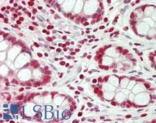 MYB / c-Myb Antibody - Human Small Intestine: Formalin-Fixed, Paraffin-Embedded (FFPE)