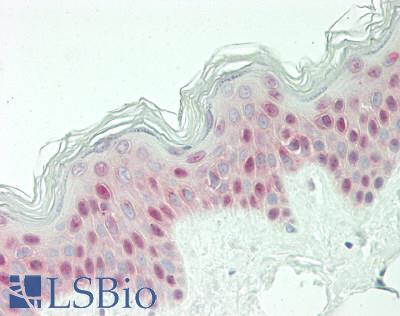 MYB / c-Myb Antibody - Human Skin: Formalin-Fixed, Paraffin-Embedded (FFPE)