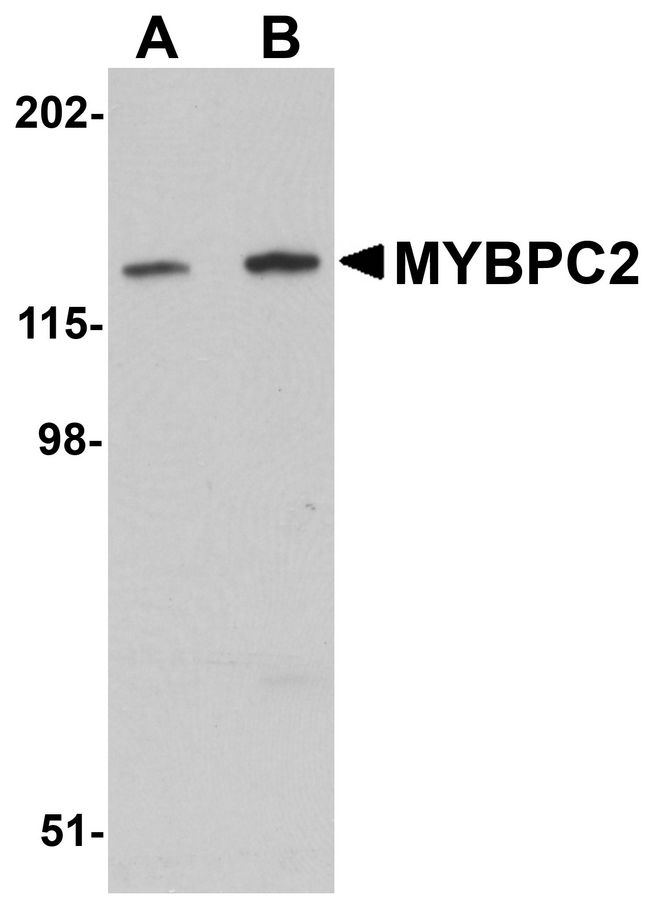 MYBPC2 Antibody - Western blot analysis of MYBPC2 in mouse skeletal muscle tissue lysate with MYBPC2 antibody at (A) 1 and (B) 2 ug/ml.