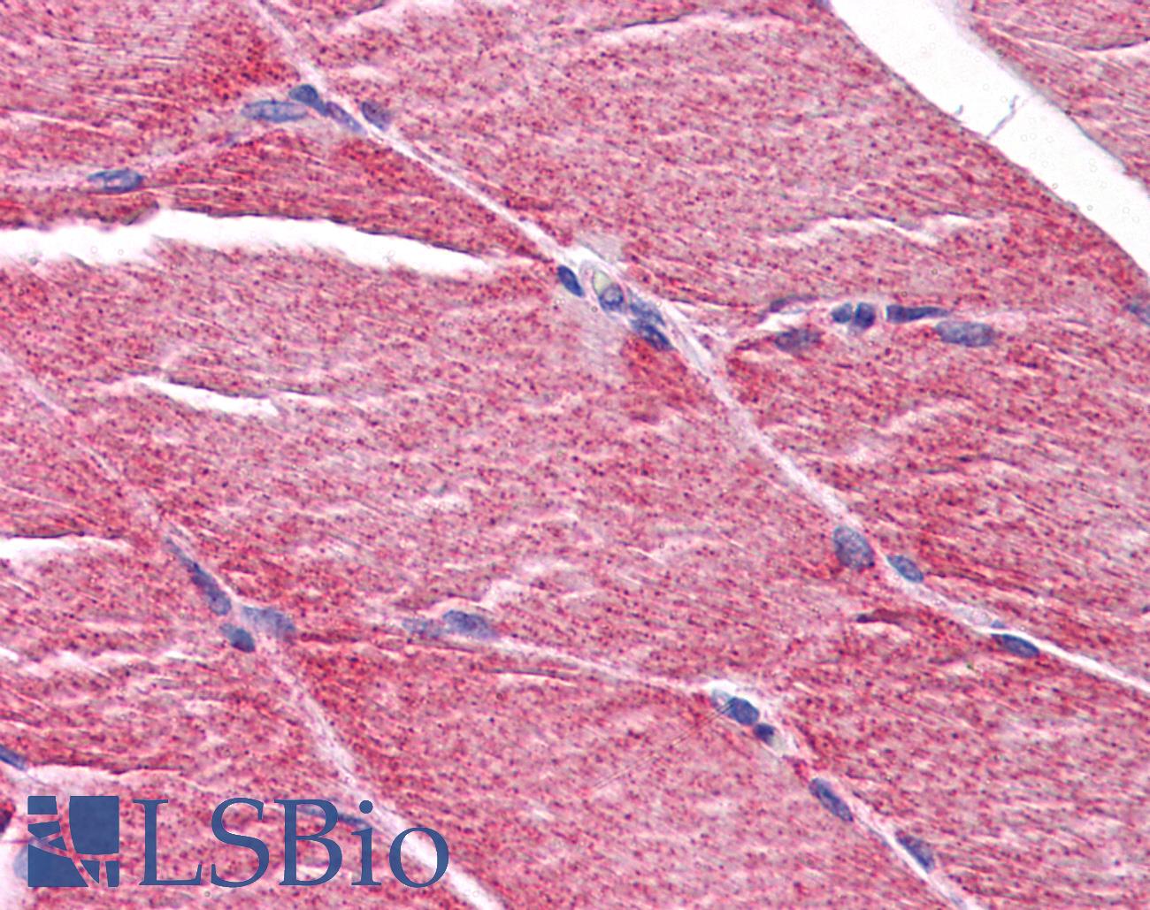 MYBPC2 Antibody - Anti-MYBPC2 antibody IHC of human skeletal muscle. Immunohistochemistry of formalin-fixed, paraffin-embedded tissue after heat-induced antigen retrieval. Antibody concentration 5 ug/ml.