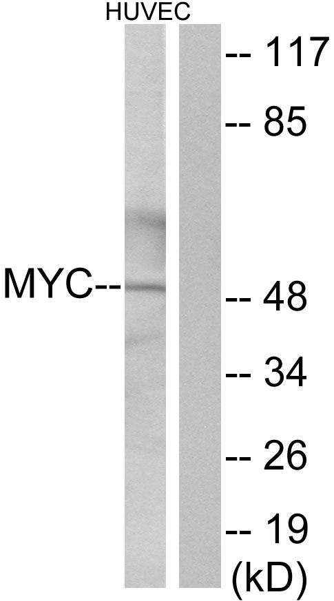 MYC / c-Myc Antibody - Western blot analysis of lysates from HUVEC cells, using MYC Antibody. The lane on the right is blocked with the synthesized peptide.