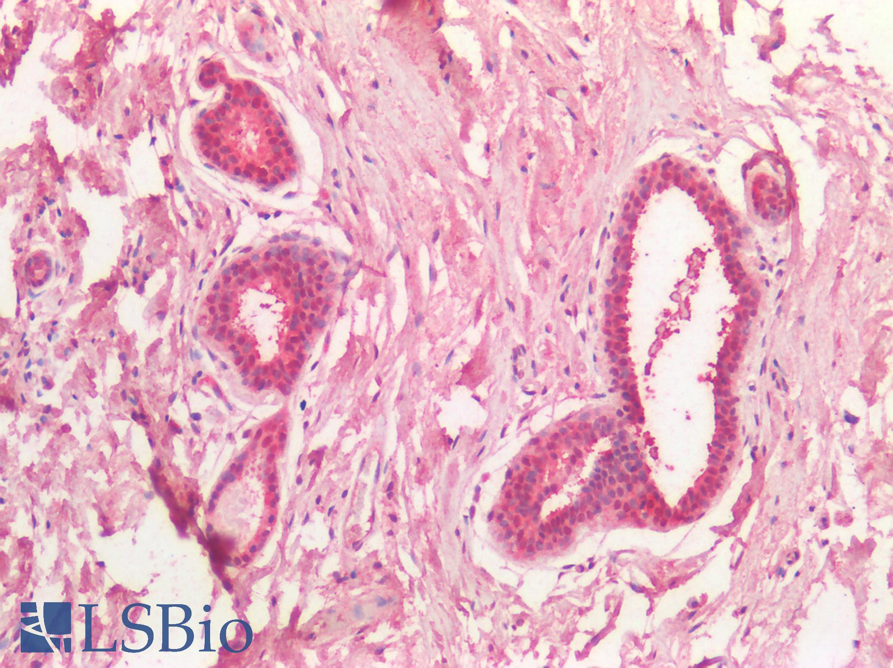 MYC / c-Myc Antibody - Human Breast: Formalin-Fixed, Paraffin-Embedded (FFPE)