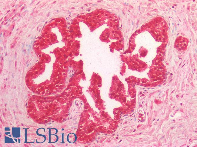 MYC / c-Myc Antibody - Human Prostate: Formalin-Fixed, Paraffin-Embedded (FFPE)