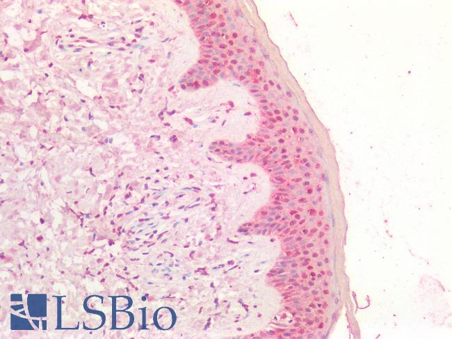 MYC / c-Myc Antibody - Human Skin: Formalin-Fixed, Paraffin-Embedded (FFPE)