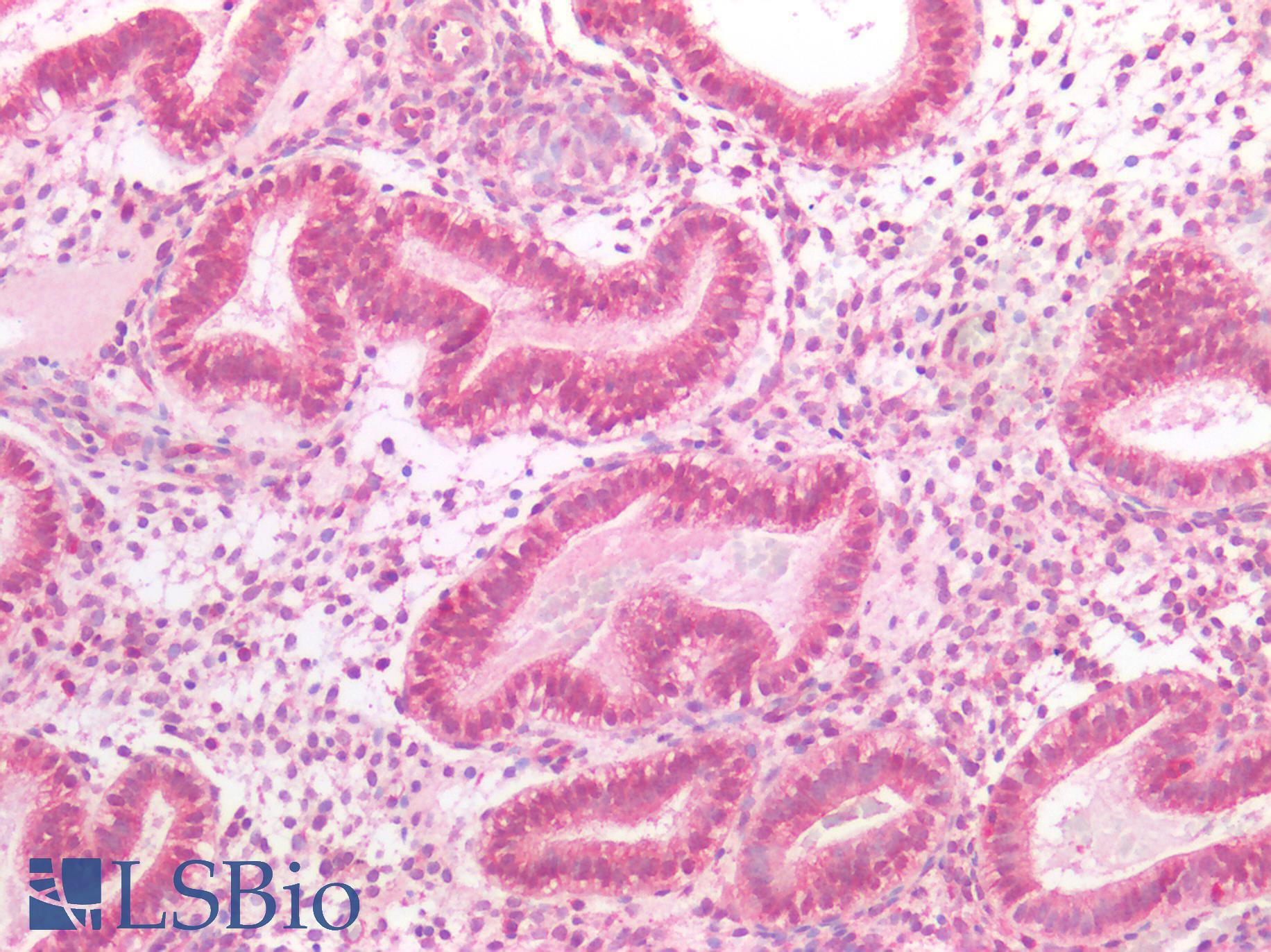MYC / c-Myc Antibody - Human Uterus: Formalin-Fixed, Paraffin-Embedded (FFPE)