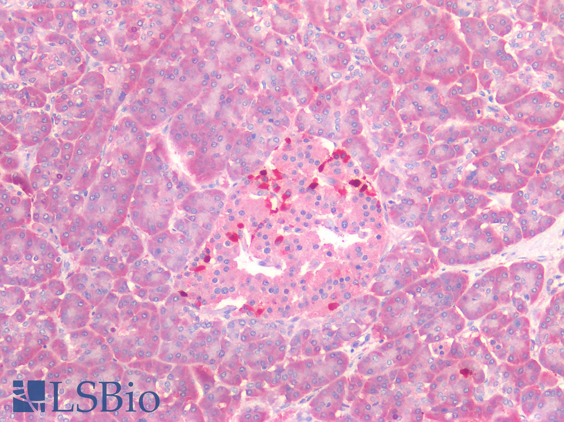 MYC / c-Myc Antibody - Human Pancreas: Formalin-Fixed, Paraffin-Embedded (FFPE)