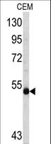 MYCN / N-myc Antibody - Western blot of MYCN antibody in CEM cell line lysates (35 ug/lane). MYCN (arrow) was detected using the purified antibody.