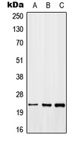 MYD118 / GADD45B Antibody - Western blot analysis of GADD45 beta expression in MCF7 (A); NIH3T3 (B); H9C2 (C) whole cell lysates.