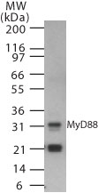 MYD88 Antibody - Western blot of MyD88 in human spleen cell lysate using 0.5 ug/ml of antibody.