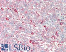 MYDGF / SF20 Antibody - Human Spleen: Formalin-Fixed, Paraffin-Embedded (FFPE), at a concentration of 10 ug/ml. 