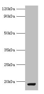 MYDGF / SF20 Antibody - Western blot All lanes: MYDGF antibody at 9µg/ml + MCF-7 whole cell lysate Secondary Goat polyclonal to rabbit IgG at 1/10000 dilution Predicted band size: 19 kDa Observed band size: 19 kDa