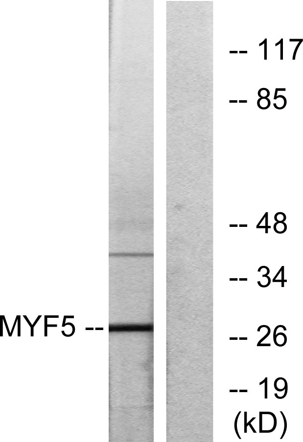 MYF5 / MYF 5 Antibody - Western blot analysis of lysates from HepG2 cells, using MYF5 Antibody. The lane on the right is blocked with the synthesized peptide.