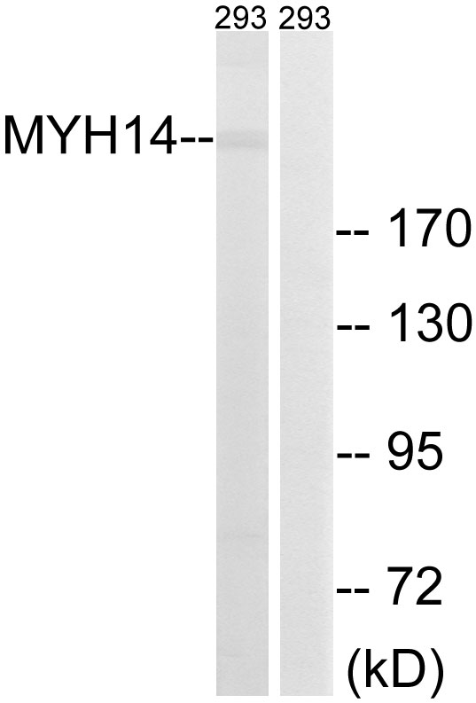 MYH14 Antibody - Western blot analysis of lysates from 293 cells, using MYH14 Antibody. The lane on the right is blocked with the synthesized peptide.