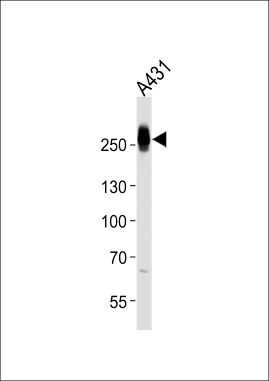 MYH14 Antibody - Western blot of lysate from A431 cell line with MYH14 Antibody. Antibody was diluted at 1:1000. A goat anti-rabbit IgG H&L (HRP) at 1:5000 dilution was used as the secondary antibody. Lysate at 35 ug.