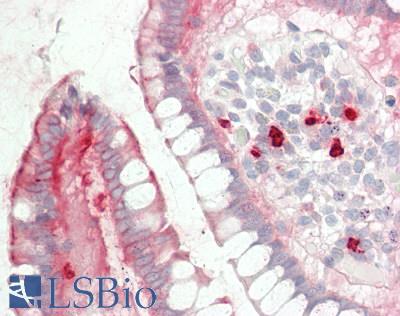 MYH14 Antibody - Human Small Intestine: Formalin-Fixed, Paraffin-Embedded (FFPE)