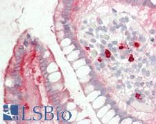 MYH14 Antibody - Human Small Intestine: Formalin-Fixed, Paraffin-Embedded (FFPE)