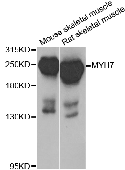 MYH7 Antibody - Western blot blot of extracts of various cell lines, using MYH7 antibody.