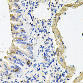 MYH7 Antibody - Immunohistochemistry of paraffin-embedded mouse lung tissue, at a dilution of 1:100