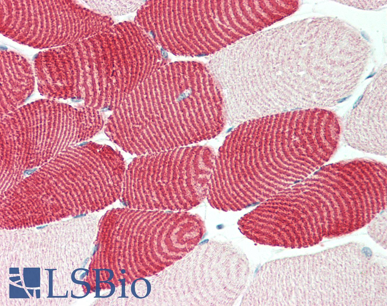 MYH7 Antibody - Skeletal muscle, human: Formalin-Fixed, Paraffin-Embedded (FFPE), at a dilution of 1:100. 
