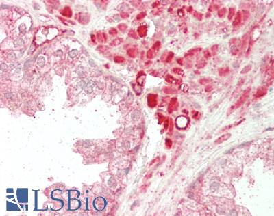 MYH9 Antibody - Human Prostate: Formalin-Fixed, Paraffin-Embedded (FFPE)