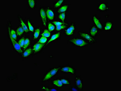 MYH9 Antibody - Immunofluorescent analysis of Hela cells using MYH9 Antibody at dilution of 1:100 and Alexa Fluor 488-congugated AffiniPure Goat Anti-Rabbit IgG(H+L)