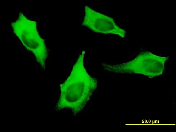 MYH9 Antibody - Immunofluorescence of monoclonal antibody to MYH9 on HeLa cell. [antibody concentration 10 ug/ml].